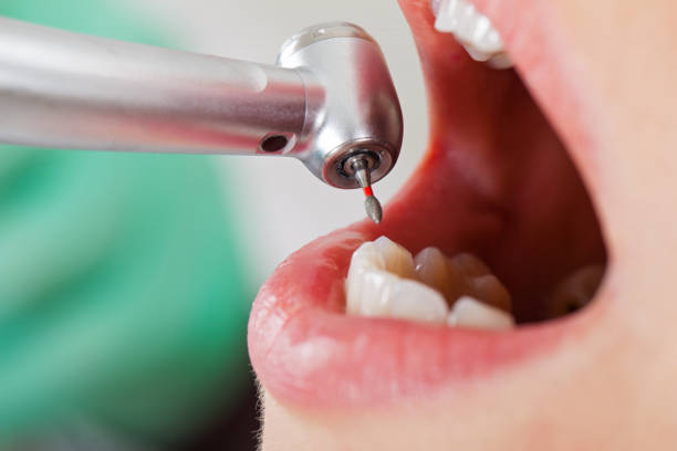 Best Emergency Dental Services for Seniors in Jeffersonville, OH